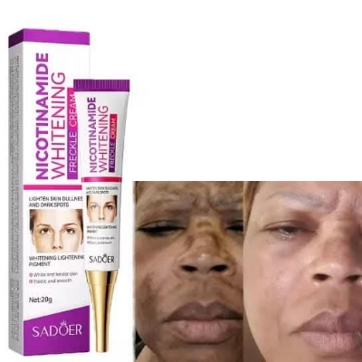 Picture of Sadoer Nicotinamide Whitening Freckle Cream 20g Lighten Dark Spots