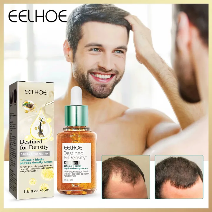 Picture of Eelhoe Biotin Fast Hair Growth Oil Hair Regrowth Serum Prevent Baldness Scalp Massage Treatment Hair Growth Liquid Anti-Hair Loss for Women and Men Dense Hair Growth Serum Dry Damaged Hair Care Essential Oil（45ml）