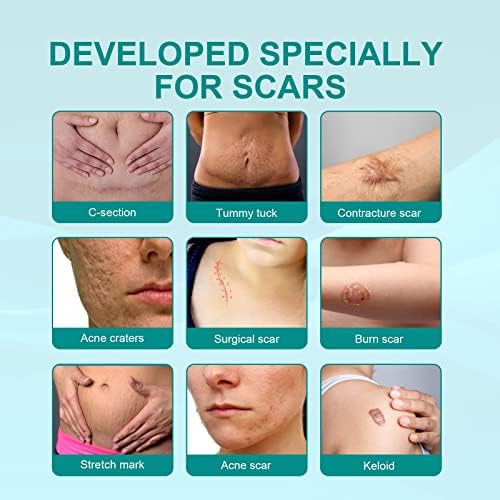 Picture of South Moon Medical Grade Scar Spray