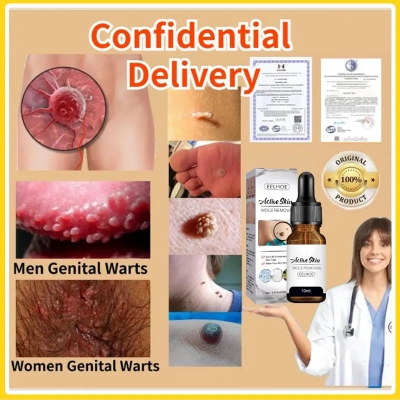 Picture of EELHOE Aclive Skin Mole Removal Essence Skin Tag Remover Mole Genital Wart Removal Antibacterial Liquid Painless Mole Skin Dark Spot Remover Serum Face Wart Tag Removal Solution 10ml