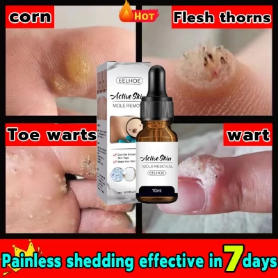 Picture of EELHOE Aclive Skin Mole Removal Essence Skin Tag Remover Mole Genital Wart Removal Antibacterial Liquid Painless Mole Skin Dark Spot Remover Serum Face Wart Tag Removal Solution 10ml
