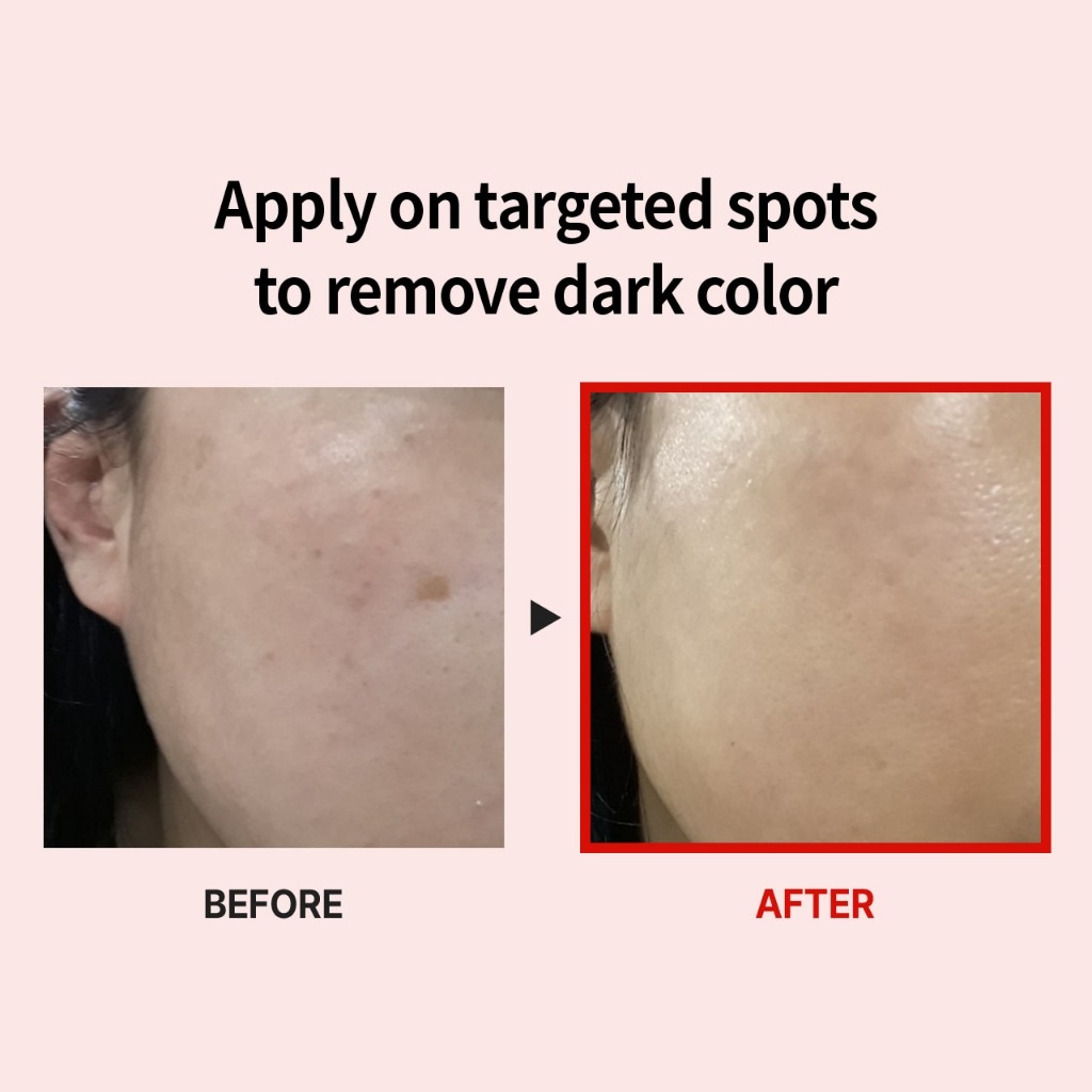 Picture of Medi-Peel Melanon X Cream 30ml