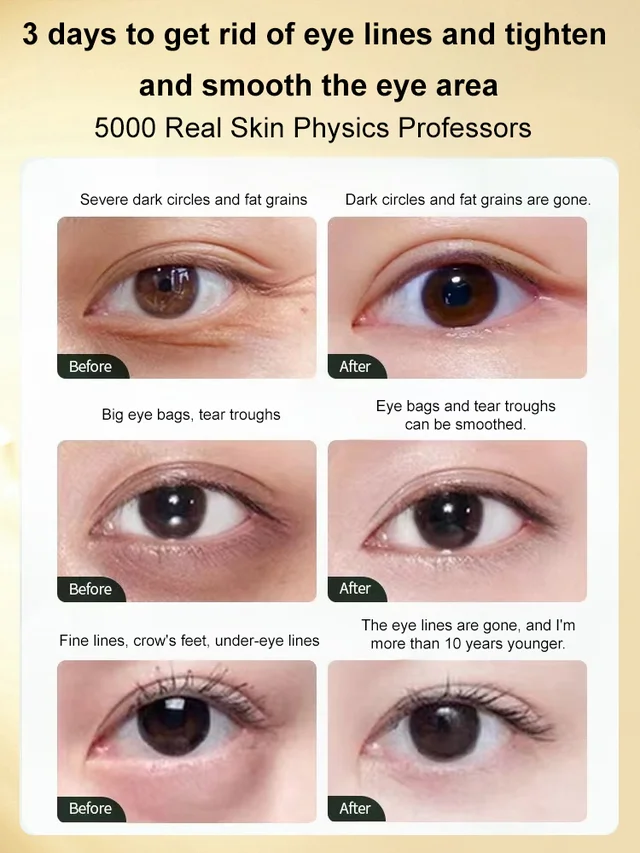 Picture of Gentian Anti-Wrinkle Eye Cream 20g