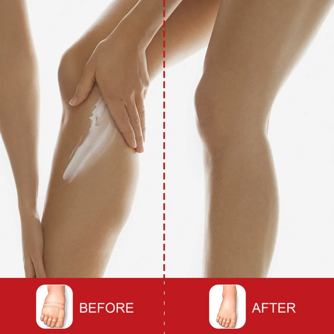 Picture of Sumifun Leg Edema Relief Cream 20g