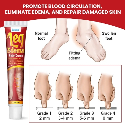 Picture of Sumifun Leg Edema Relief Cream 20g