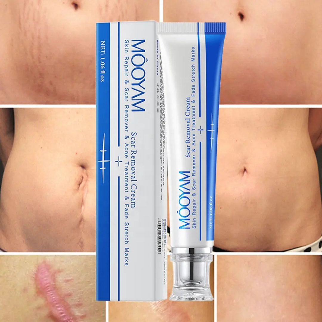 Picture of MOOYAM Scar Removal Cream