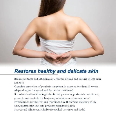 Picture of South Moon Psoriasis Relief Spray Net: 30ml