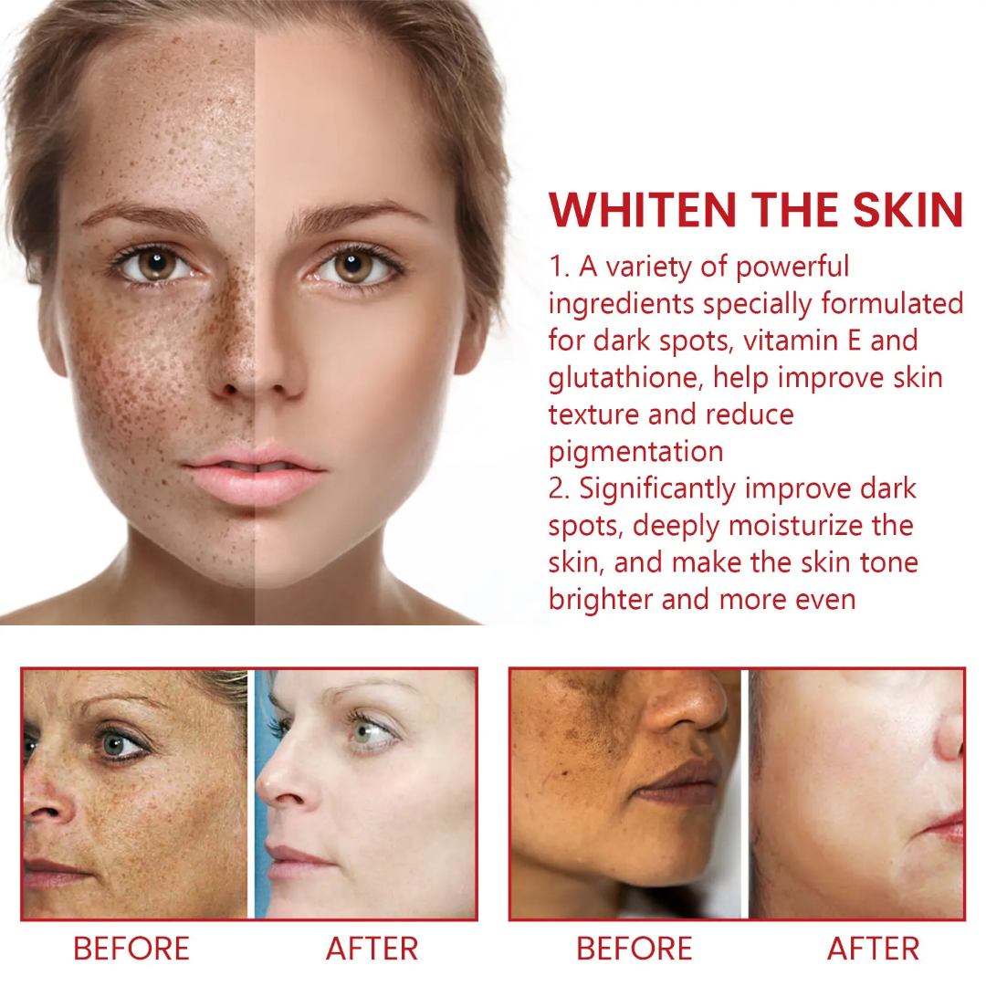 Picture of Ouhoe Dark Spot Cream 30ml