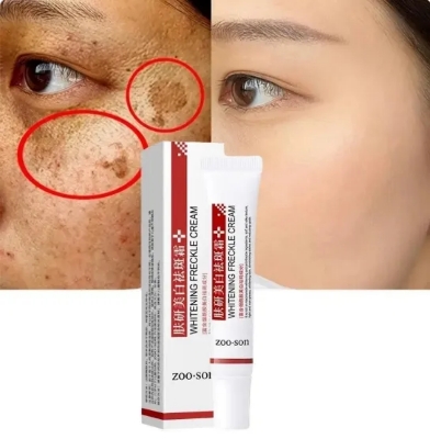Picture of Zoo Son Whitening Freckle Cream