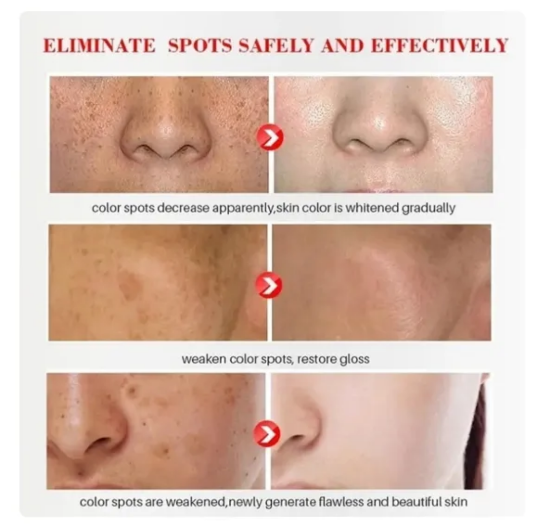 Picture of Zoo Son Whitening Freckle Cream