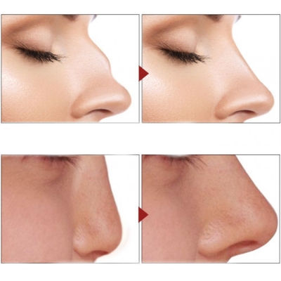 Picture of Bonixiya Nose Massage Essential Oil 30ml