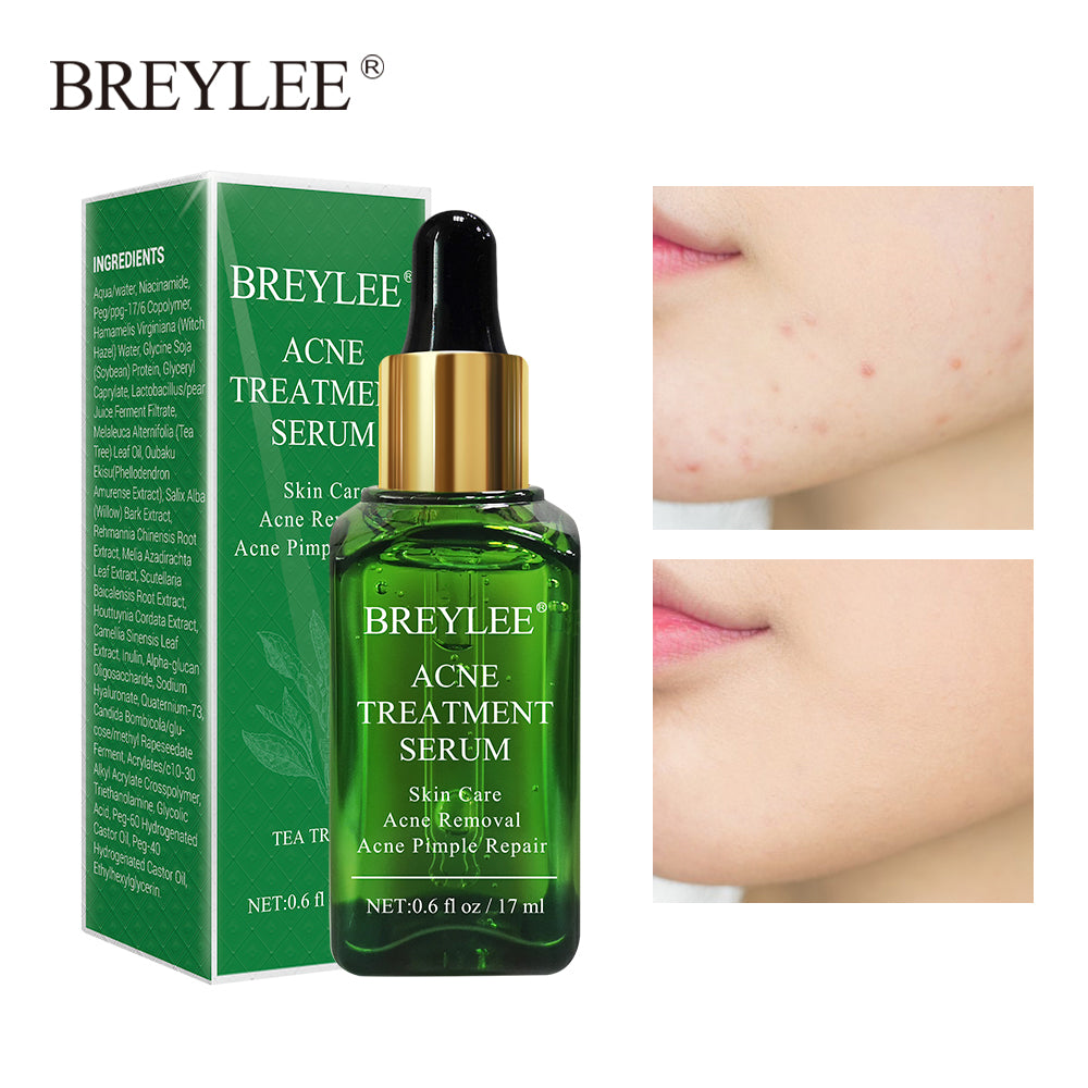 Picture of BREY_LEE Acne Treatment Serum 17ml