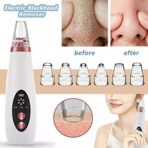 Buy Multi functional cleaning Remove blackhead device best Price in Bangladesh Best price In BD at Best Price In Bangladesh