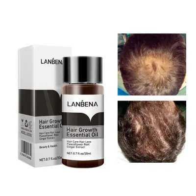 Picture of LANBENA Hair Growth Essential Oil -20 ml