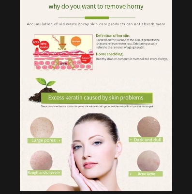 Picture of Yan Namei Ji Pomegranate Peeling Gel - 320ml