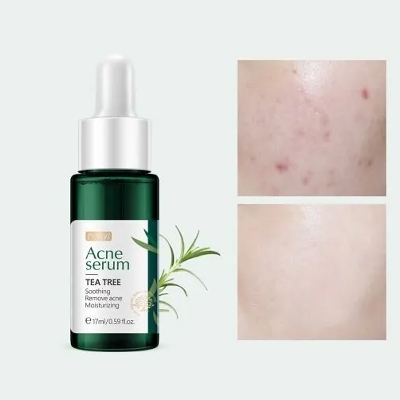 Picture of FENYI Tea Tree Acne Serum -17ml