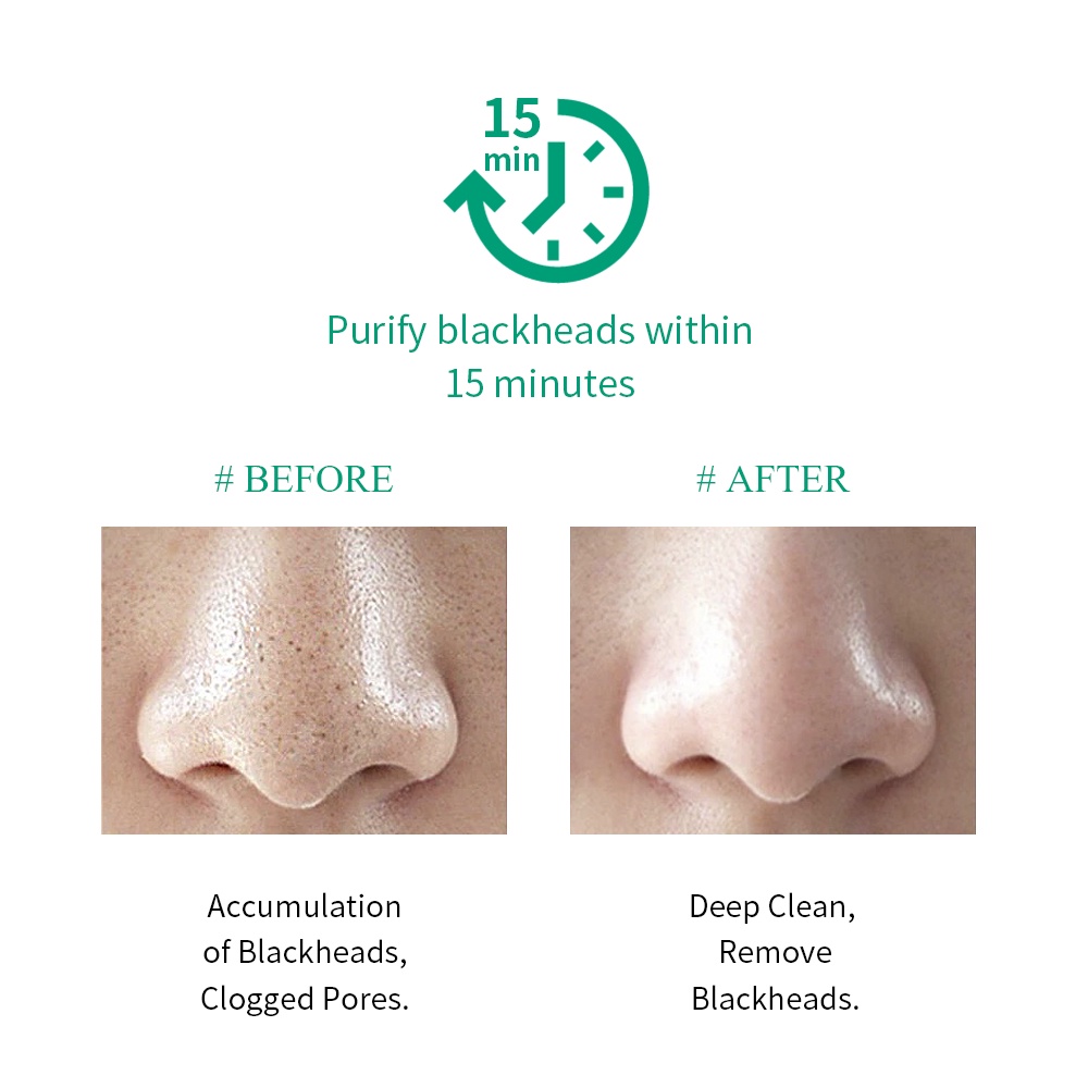 Picture of Breylee Tea Tree Blackhead Mask Step -1