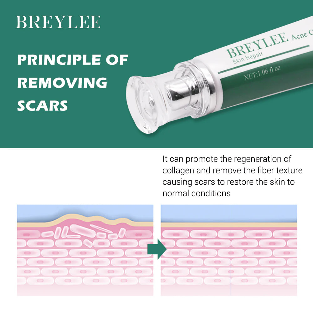 Picture of Breylee Skin Repair Acne Cream - 30g