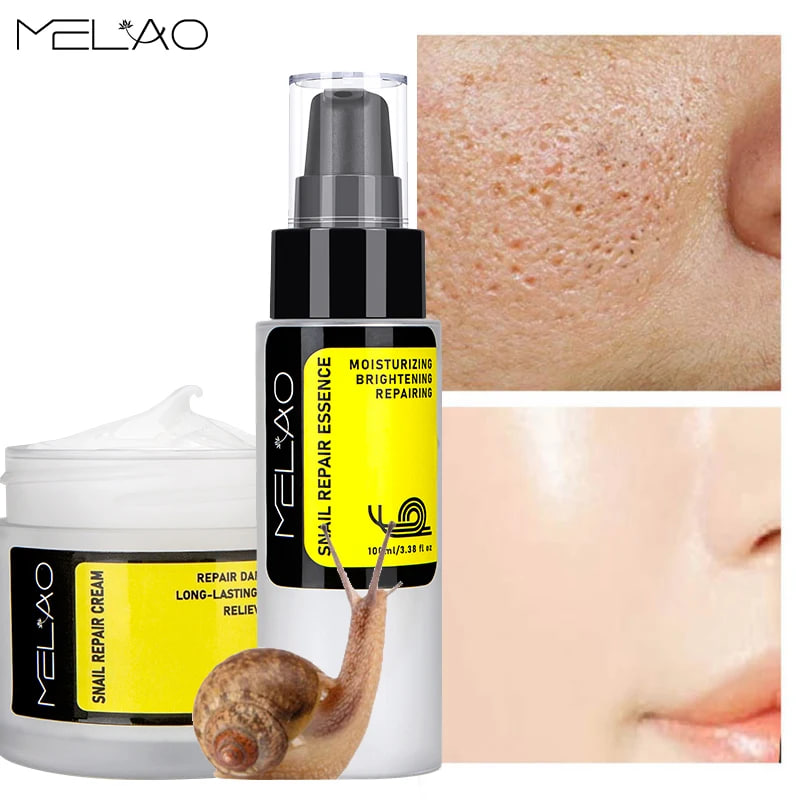 Picture of Melao Snail Repair Essence and Cream ( 100ml + 50gm )