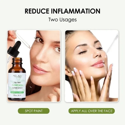 Picture of Melao Tea Tree Clear Skin Super Serum – 30ml