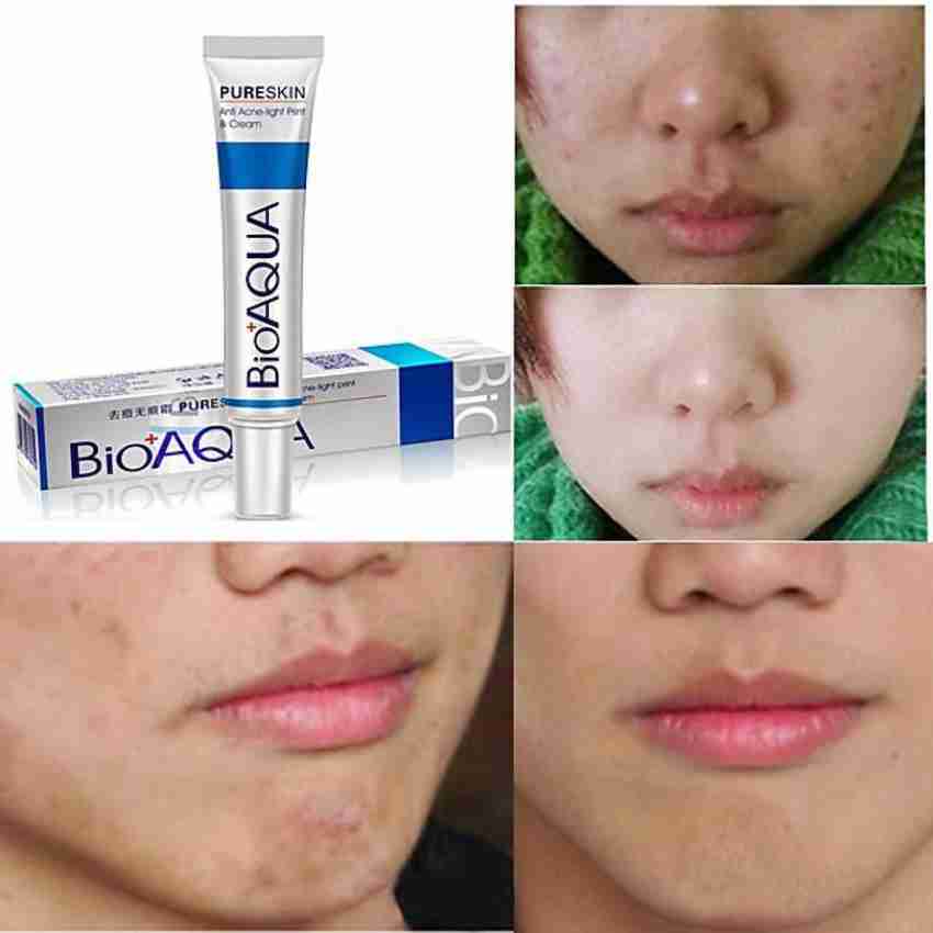 Picture of BIOAQUA Pure Skin Acne Removal and Rejuvenation Cream - 30g