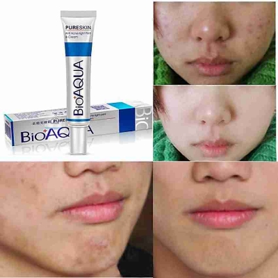 Picture of BIOAQUA Pure Skin Acne Removal and Rejuvenation Cream - 30g