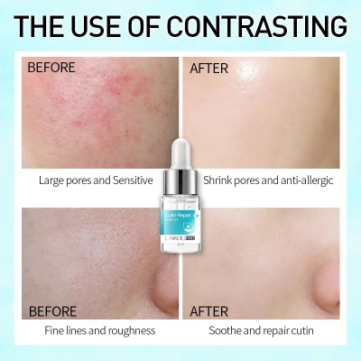 Picture of LAIKOU Pro Shrink Pores Cutin Repair Serum- 12ml