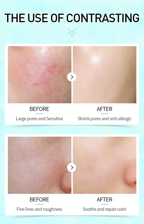 Picture of LAIKOU Pro Shrink Pores Cutin Repair Serum- 12ml