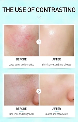 Picture of LAIKOU Pro Shrink Pores Cutin Repair Serum- 12ml