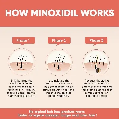 Picture of Kirkland Signature Topical Minoxidil 5% Extra Strength for Men Hair Regrowth Treatment - 1 Month Supply