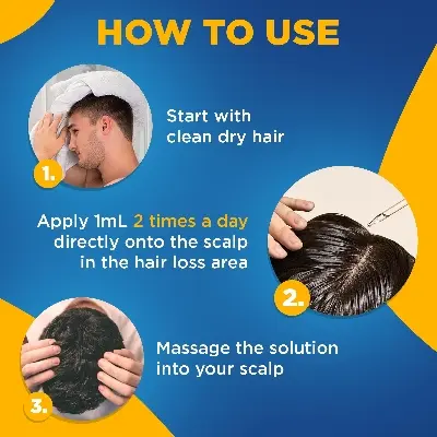 Picture of Kirkland Signature Topical Minoxidil 5% Extra Strength for Men Hair Regrowth Treatment with Derma Roller - 1 Month Supply