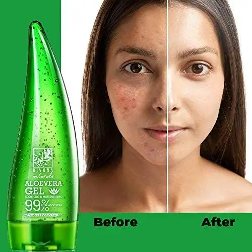 Picture of Alovera Gel 99% soothing gel