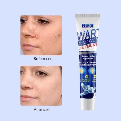 Picture of Warts & Skin Tag Remover Ointment: Treatment Cream