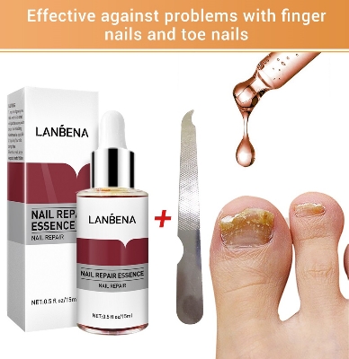 Picture of Lanbena Nail Repair Essence is used to treat and repair damaged or infected nails