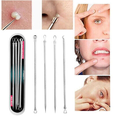 Picture of 4pcs/set Blackhead Comedone Acne Pimple Blackhead Remover Tool Spoon for Face Skin Care Tool Needles Facial Pore Cleaner - skin care tools