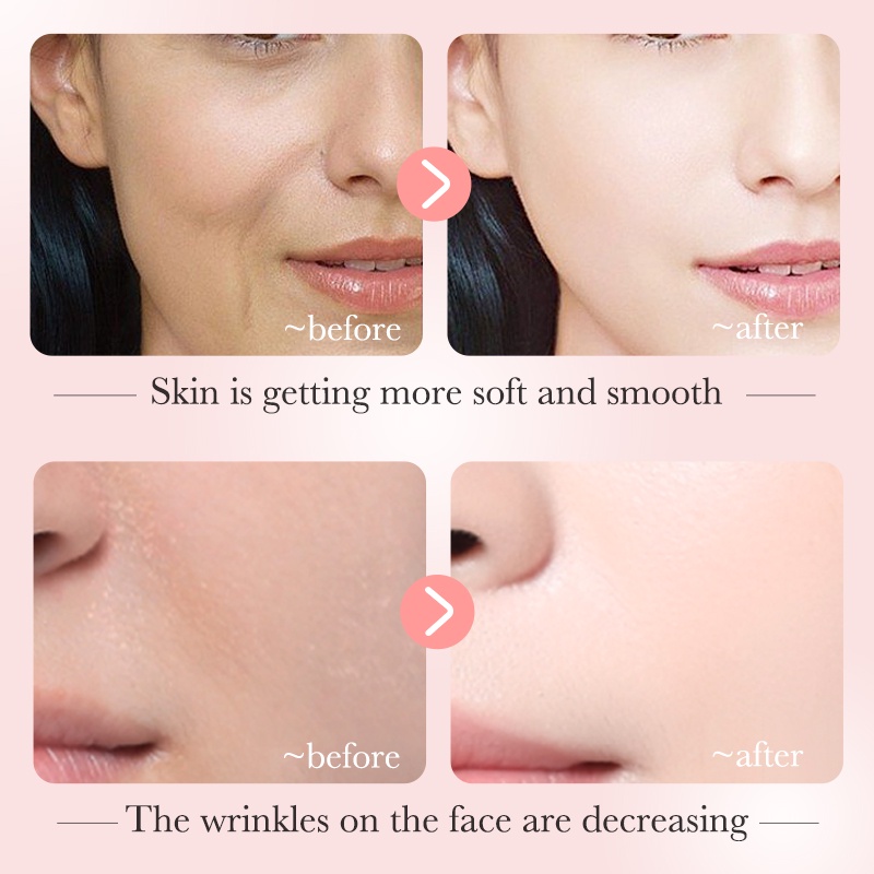 Picture of Bioaqua Nicotinamide Serum Dispel Freckle Whitening Stable Soothing Essence  - 30ml