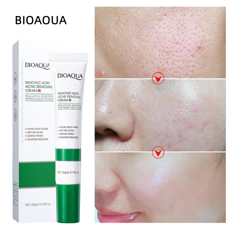 Picture of BIOAQUA Salicylic Acid Face Cream Acne Creams Mark Repair skin Facial Cream 20g