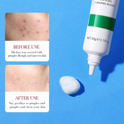 Picture of BIOAQUA Salicylic Acid Face Cream Acne Creams Mark Repair skin Facial Cream 20g