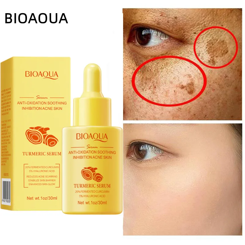 Picture of BIOAQUA Turmeric Serum Anti-Oxidation Soothing Inhibition Acne Skin Essence - 30ml
