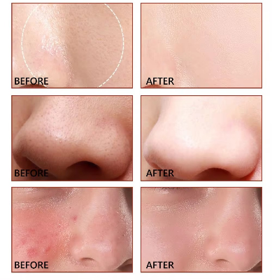 Picture of Vibrant Glamour Shrink Pore Minimizer Serum - 30ml