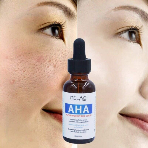 Picture of MELAO AHA Alpha Hydroxy Acid Serum 30ml / 1 oz