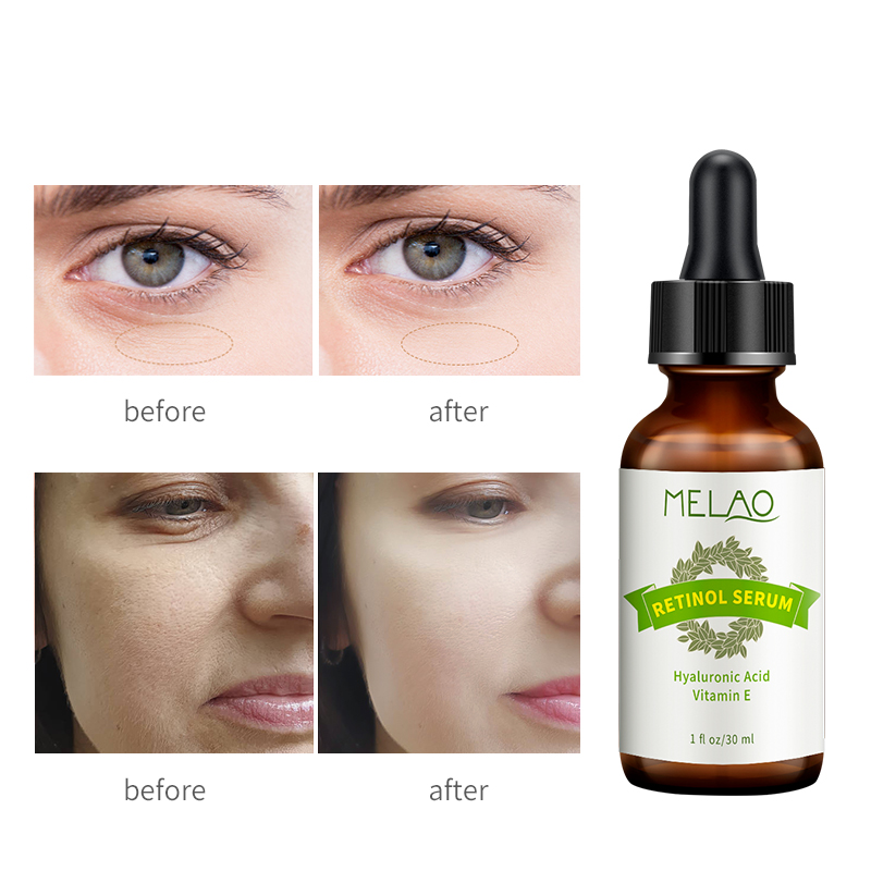 Picture of Melao Retinol Serum with Hyaluronic Acid & Vitamin E Serum - 30ml