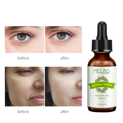 Picture of Melao Retinol Serum with Hyaluronic Acid & Vitamin E Serum - 30ml