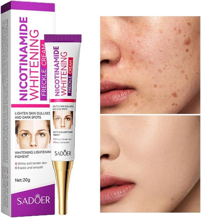 Picture of SADOER Nicotinamide Whitening Lightening Spots Freckle Face Cream 20g