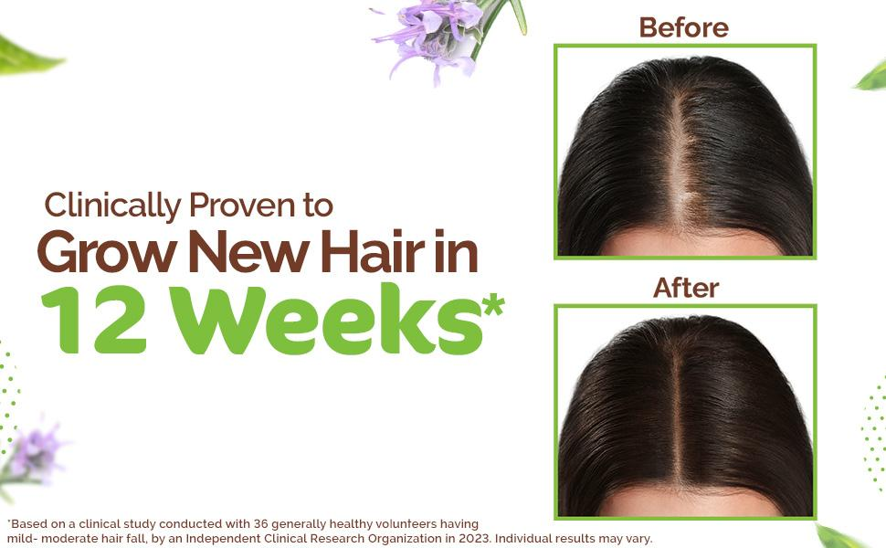 Picture of Mamaearth Rosemary Hair Oil for Hair Growth & Hair Fall Control with Fenugreek Seed | Strengthens Roots, Non-Sticky & Natural Scalp Oil for Men & Women | 150ml (5.07 Fl Oz)