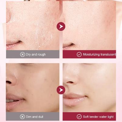 Picture of SADOER Azelaic Acid Luxury Serum Rejuvenating Facial Serum with Azelaic Acid - 30ml