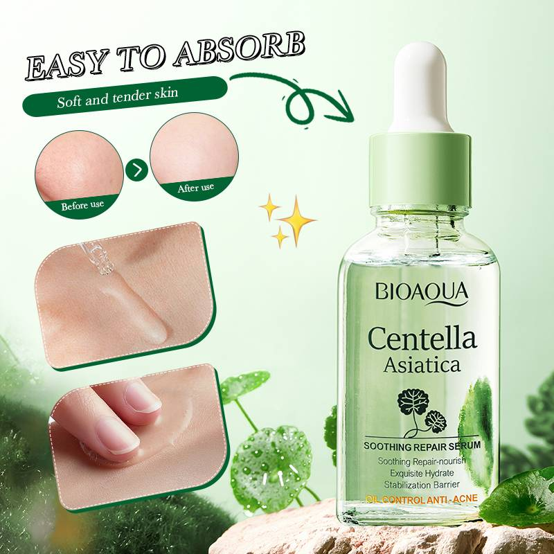 Picture of Bioaqua Centella Asiatica Soothing Repair Anti Acne Face Serum Essence - 30ml