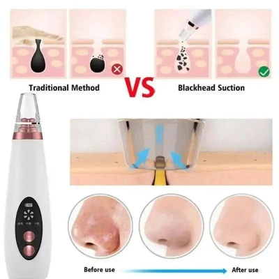 Picture of Rechargeable Blackheads and Whiteheads remover for Men & Women