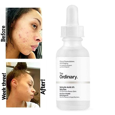 Picture of Salicylic Acid 2% Solution