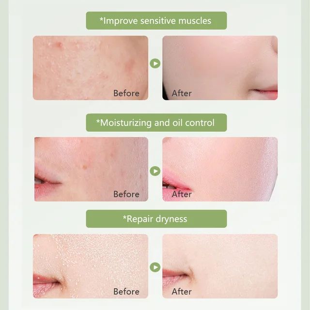 Picture of Aloe Vera 99% Moisturize Shooting Gel